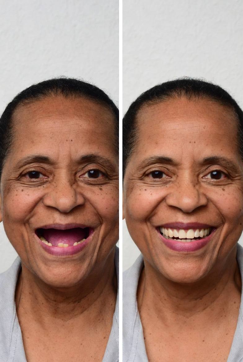 Dental Transformation 1
