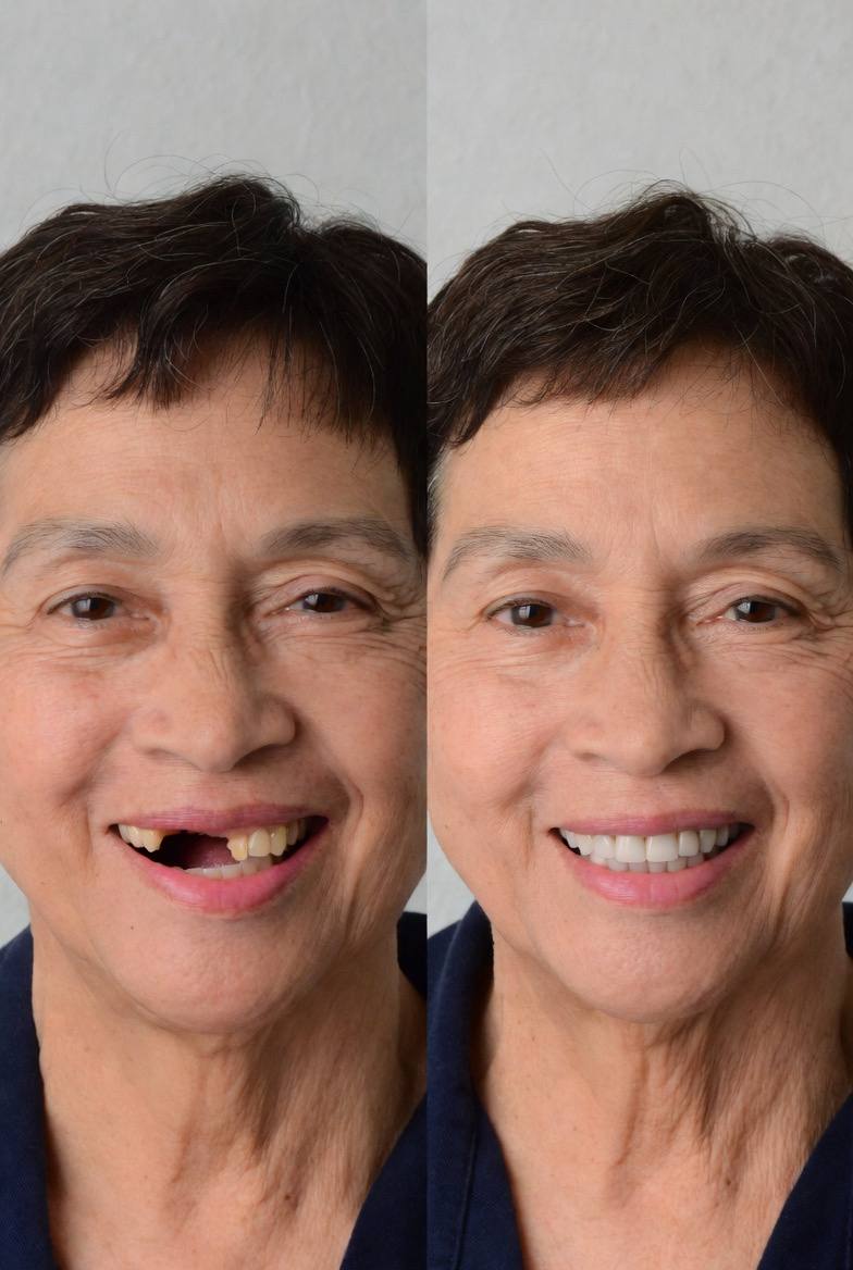 Dental Transformation 4